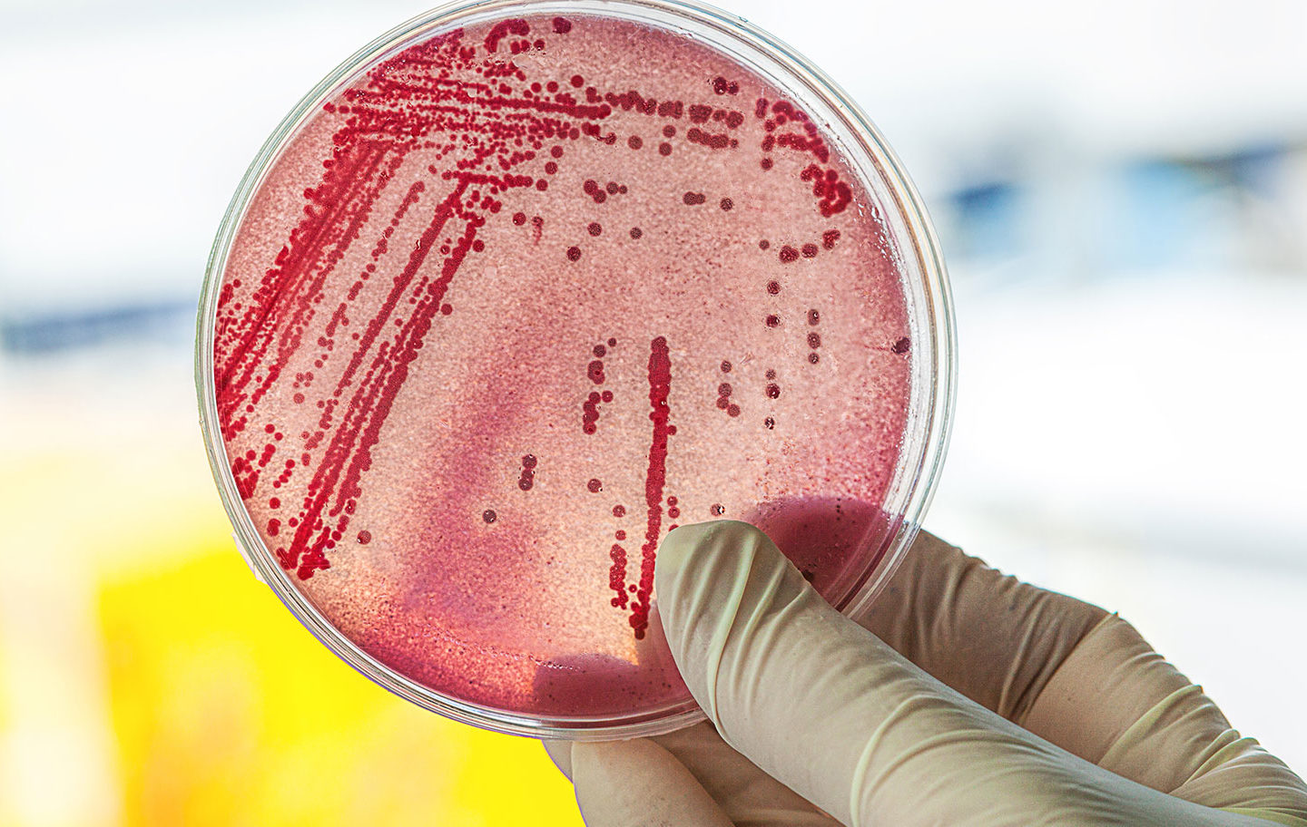 E-coli-Bakterien - das machen sie im Darm. Foto Petrischale