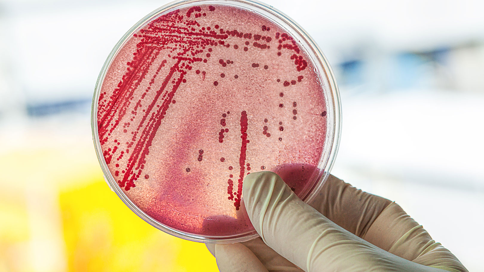 E-coli-Bakterien - das machen sie im Darm. Foto Petrischale